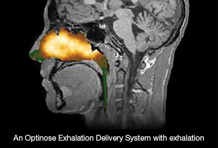 Gamma scintigraphy showing deposition with a nasal spray without exhalation and an Optinose EDS